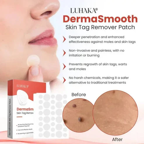 Skin Tag Remover Patch