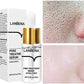 Pore Solution Serum (Original)