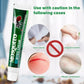Sumifun Mosquito Bite Relief Cream