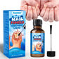 Sumifun – Anti Fungal Nail Repair Solution (Original)